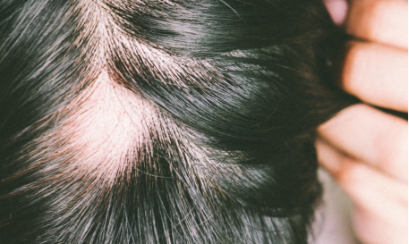 Pigmentation & Dull Skin